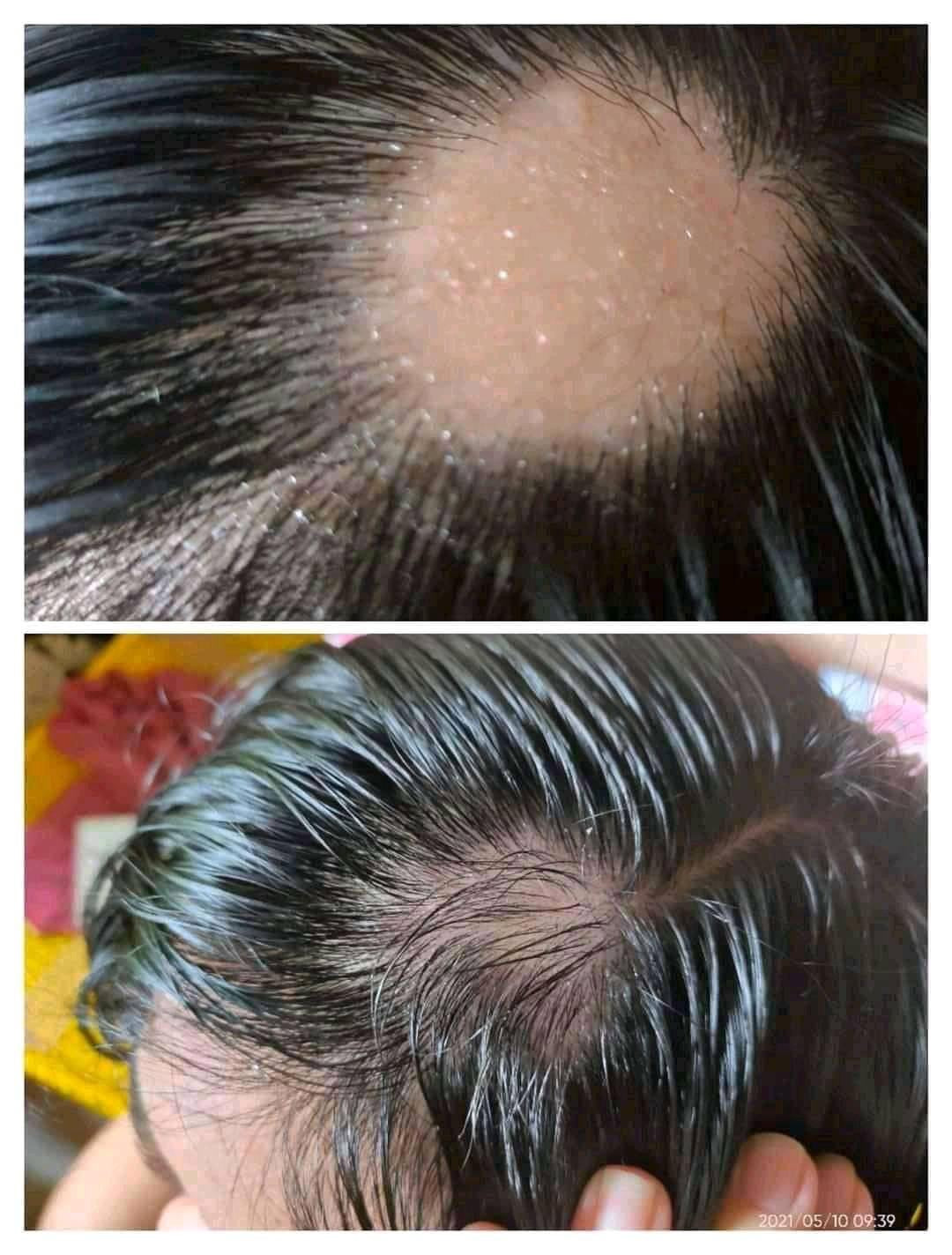 Merry Sun Ginger Hair Growth Spray - 30ml Special Offer